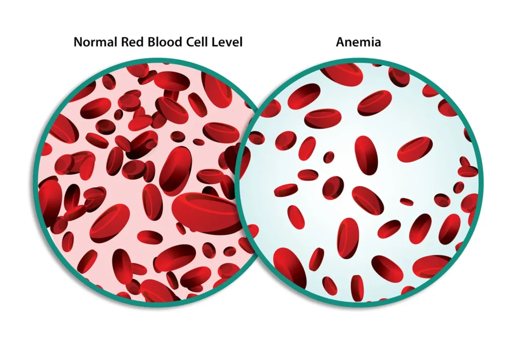 1800ss getty rf normal blood vs anemia 1 1800ss getty rf normal blood vs anemia 1